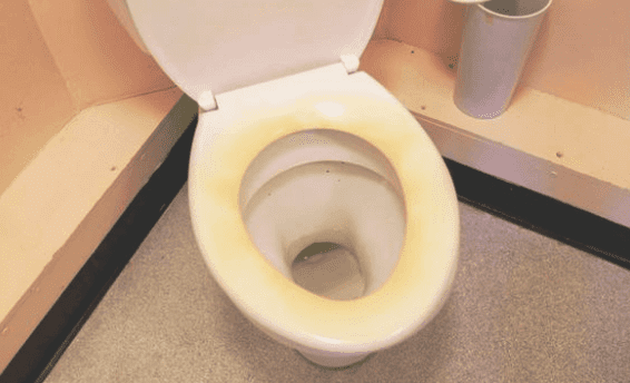 Urine Around the Toilet Base