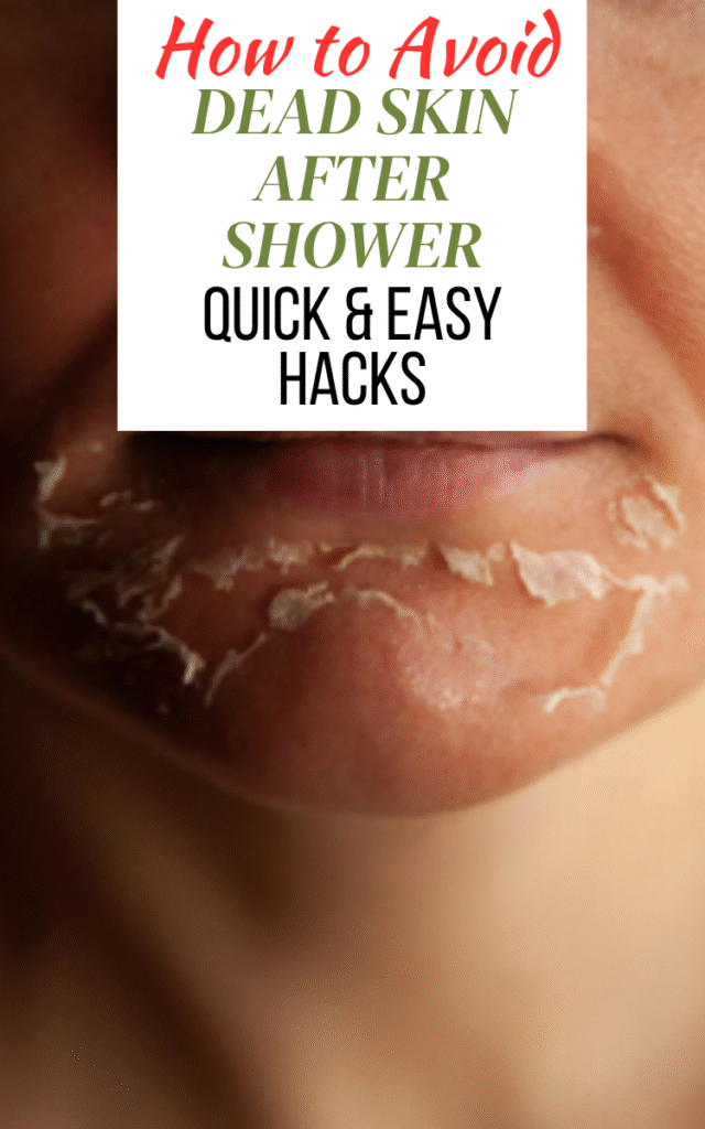 How to Avoid Dead Skin After Shower