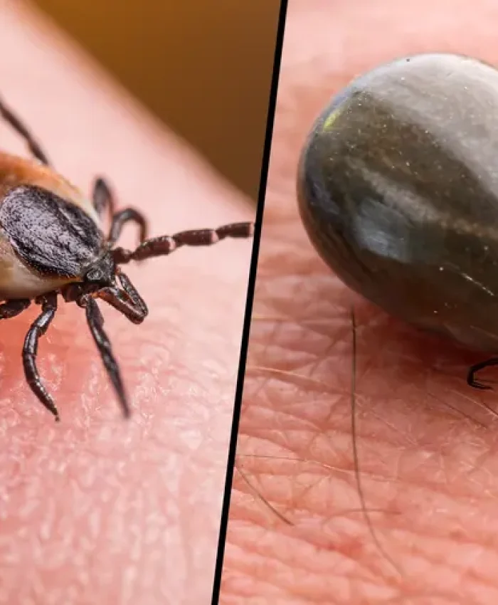 Ways to Get Rid of Ticks in Your Yard Naturally