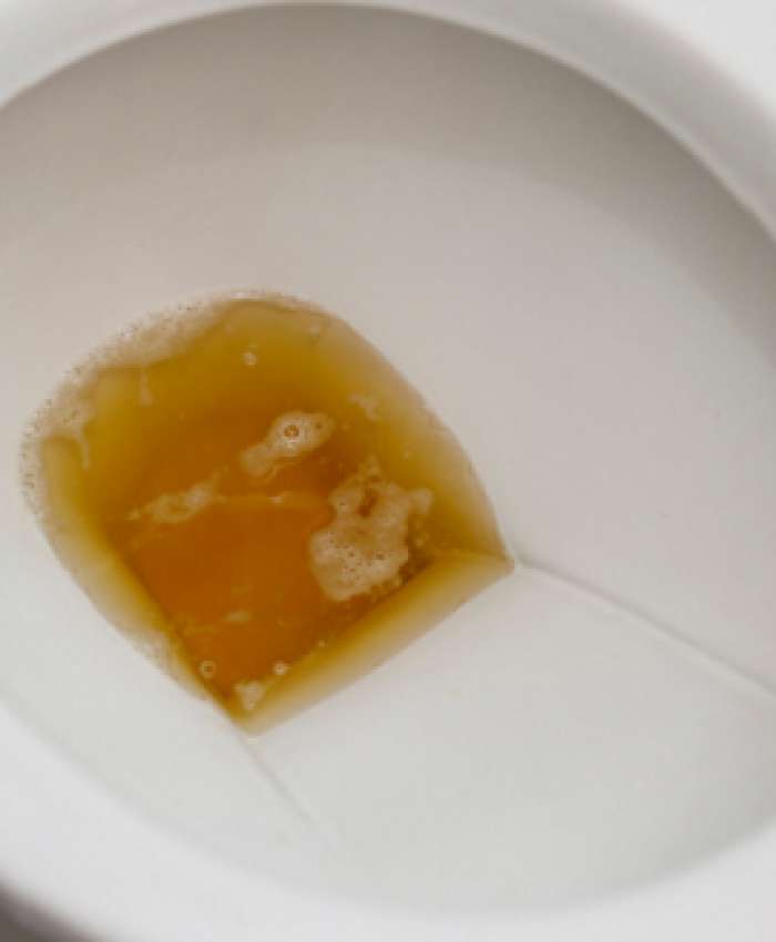 Reasons Why Urine Sinks to Bottom of Toilet?