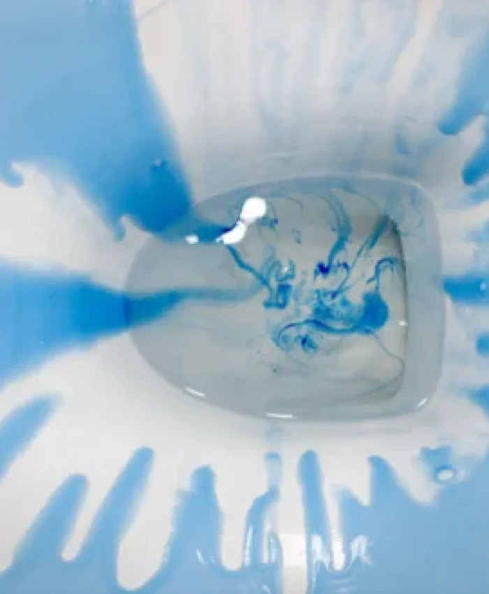 How to Get Blue Toilet Cleaner off Hands