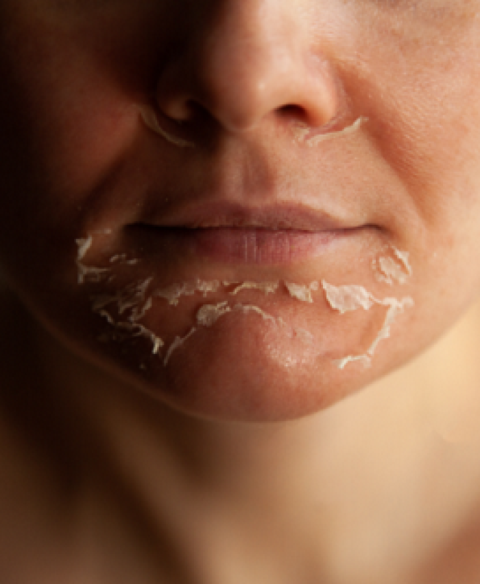 How to Avoid Dead Skin After Shower